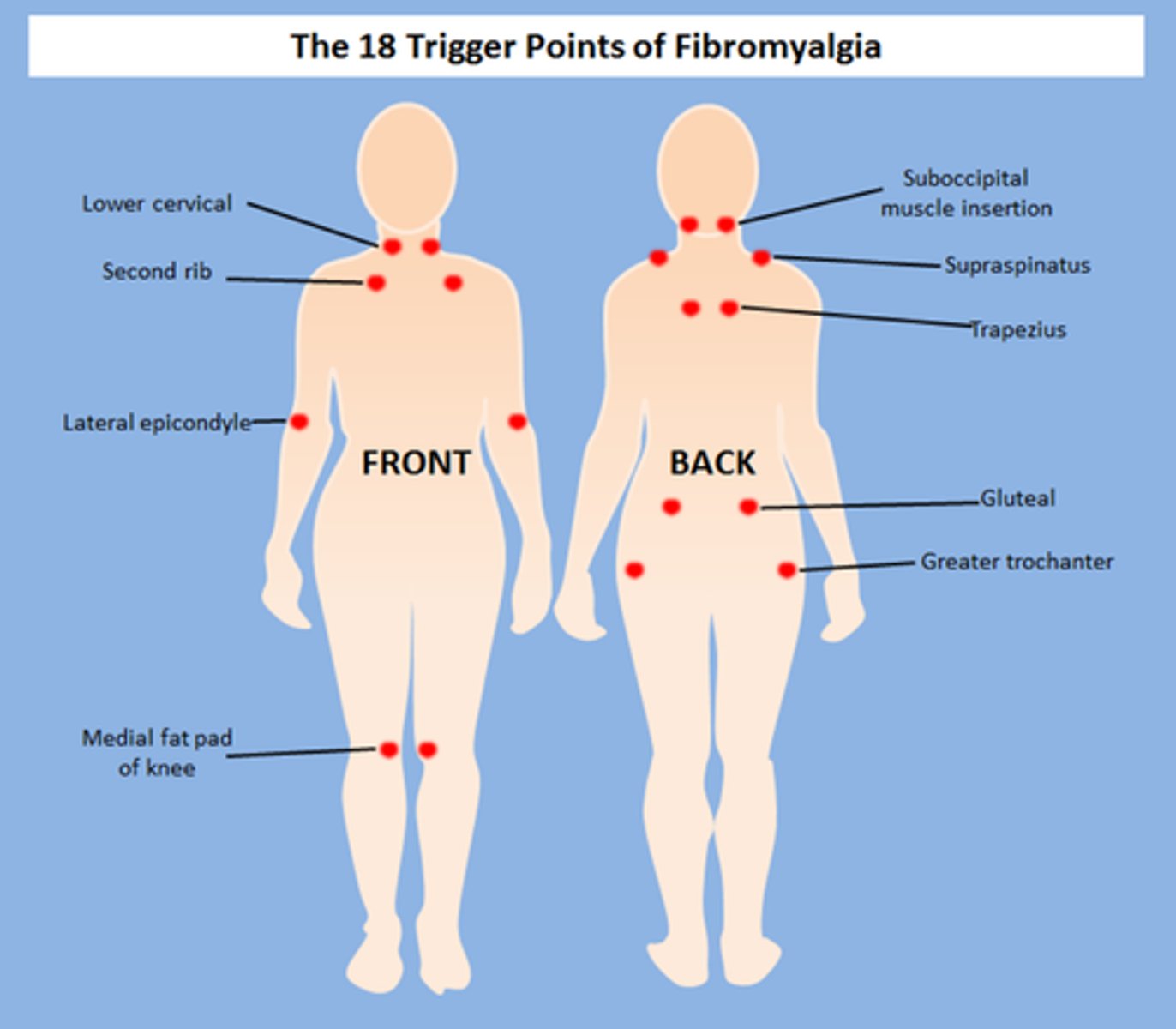 <p>fibromyalgia → sx &gt;3 months in 4 quadrants</p>