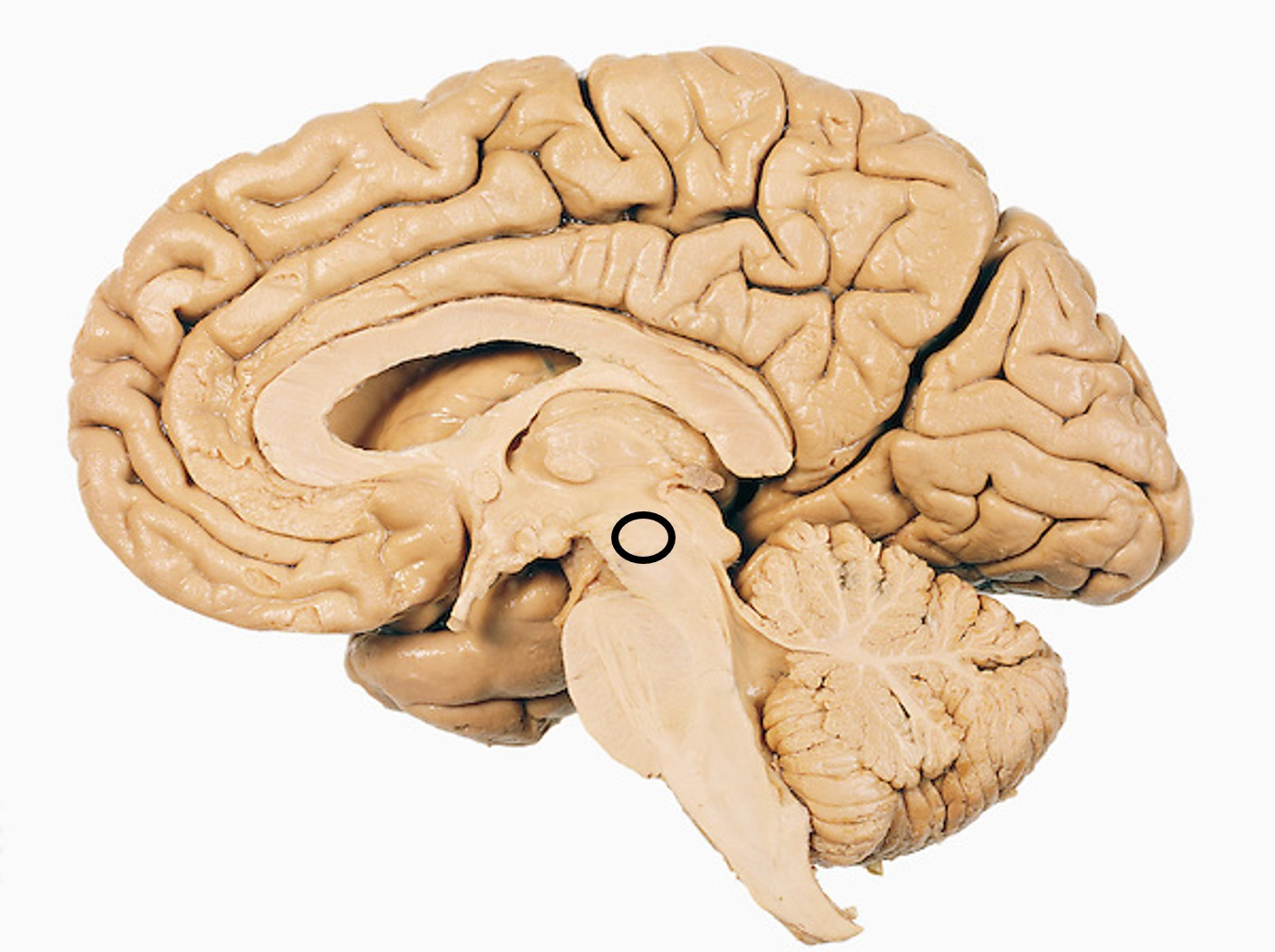 <p><span style="font-family: Lato Extended, Lato, Helvetica Neue, Helvetica, Arial, sans-serif; color: rgb(45, 59, 69)">The circled area is the</span></p>