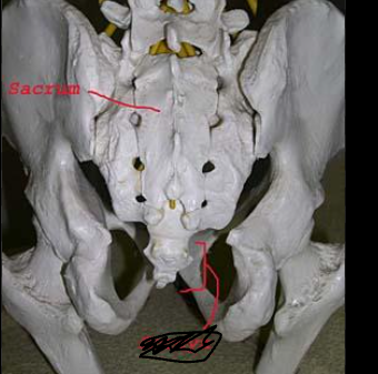 <p>which bone is scratched out?</p>