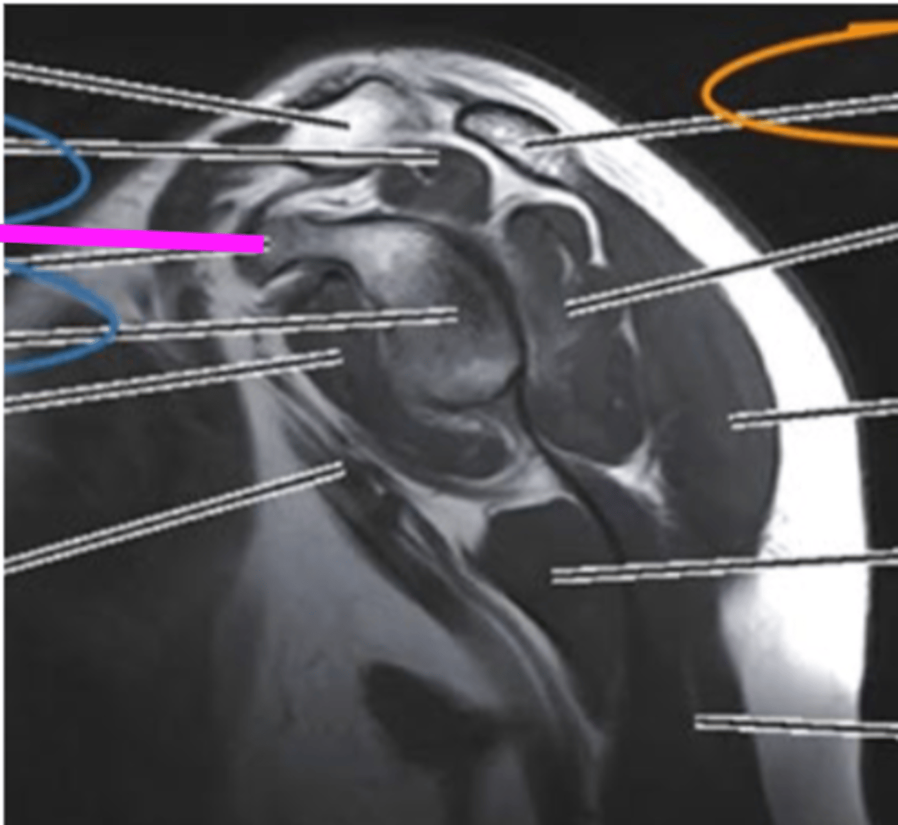 <p>what does the pink line point to?</p>