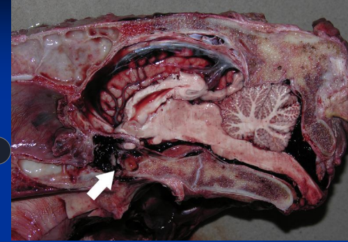 <ul><li><p><strong><u>Common injury: direct impact</u></strong></p></li><li><p><span style="background-color: transparent;"><strong><span>Et: </span></strong></span><span style="background-color: transparent; color: red;"><strong><u><span>edema #1!!**</span></u></strong></span><span style="background-color: transparent;"><span>, ↑ ICP, herniation</span></span></p><ul><li><p><u>severe/uncontrolled edema</u>: cerebral and/or cerebellar herniation</p></li></ul></li><li><p><span style="background-color: transparent;"><strong><span>Cs: </span></strong><span>Depression, recumbency w/ stupor or coma, </span></span><span style="background-color: transparent; color: red;"><span>vestibular signs,</span></span><span style="background-color: transparent;"><span> </span></span><span style="background-color: transparent; color: red;"><span>blood/CSF from ears/nose = fracture</span></span><span style="background-color: transparent;"><span>, abnormal pupils, head tilt</span></span></p><ul><li><p><span style="background-color: transparent;"><strong><span>Frontal/parietal/orbital: </span></strong></span><span style="background-color: transparent; color: red;"><span>concussion, contusion, hemorrhage</span></span><span style="background-color: transparent;"><span>, brain parenchyma disruption</span></span></p></li><li><p><span style="background-color: transparent;"><strong><span>Petrous temporal/occipital: very common - young by flipping over backwards</span></strong></span></p><ul><li><p><span style="background-color: transparent;"><span>vestibular dysfunction, facial paralysis, bleeding from ears, optic nerve damage</span></span></p></li></ul></li><li><p><span style="background-color: transparent;"><strong><span>Poll injuries:</span></strong><span> </span></span><span style="background-color: transparent; color: red;"><span>hyperextension of neck,</span></span><span style="background-color: transparent;"><span>&nbsp; basilar fractures = fractures/b-sphenoid &amp; b-occipital bone separation = </span></span><span style="background-color: transparent; color: red;"><span>intracranial hemorrhage &amp; severe brain injury,</span></span><span style="background-color: transparent;"><span> </span><u><span>guttural pouch hemorrhage, </span></u></span><span style="background-color: transparent; color: red;"><u><span>tearing optic nerve: </span></u><span>blindness</span></span></p><ul><li><p> Rupture/avulsion of ventral straight mm &amp;/or fracture at base of brain</p></li></ul></li></ul></li><li><p><span style="background-color: transparent;"><strong><span>Dt: </span></strong><span>rads, CT, MRI, endoscopy</span></span></p></li><li><p><span style="background-color: transparent;"><strong><span>Tx: </span></strong></span><span style="background-color: transparent; color: red;"><span>Stabilize airway / padding</span></span><span style="background-color: transparent;"><span>, IV catheter, </span><u><span>Mannitol/furosemide (not w/ hemorrhage), hypertonic saline</span></u><span>, hyperventilation (foals), Sx for fragments, monitor BP</span></span></p><ul><li><p><strong>poor prognosis →</strong><u> hemorrhage in CSF, recumbence, seizures, coma, fixed pupils, erratic breathing</u></p></li></ul></li></ul><p></p>