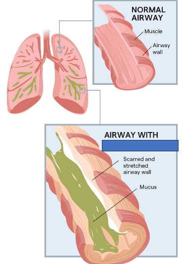 <p>What does this refer to </p>