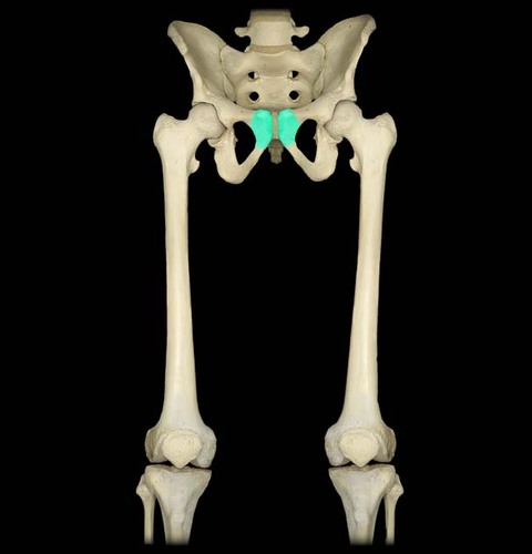 <p>Pubic Tubercle</p>