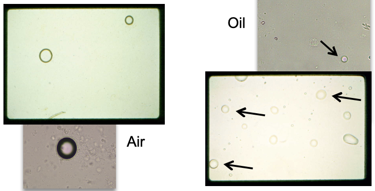 <ul><li><p class="">Highly refractile, spherical objects</p></li><li><p class="">May mimic RBCs under light microscopy</p></li><li><p class=""><strong>Oil</strong> tends to float; <strong>air bubbles</strong> may have a dark edge or central refractile ring</p><p class=""></p></li></ul><p></p>