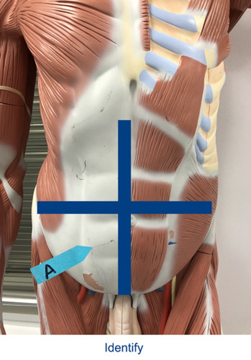 <p>Identify the area indicated by the arrow.</p>