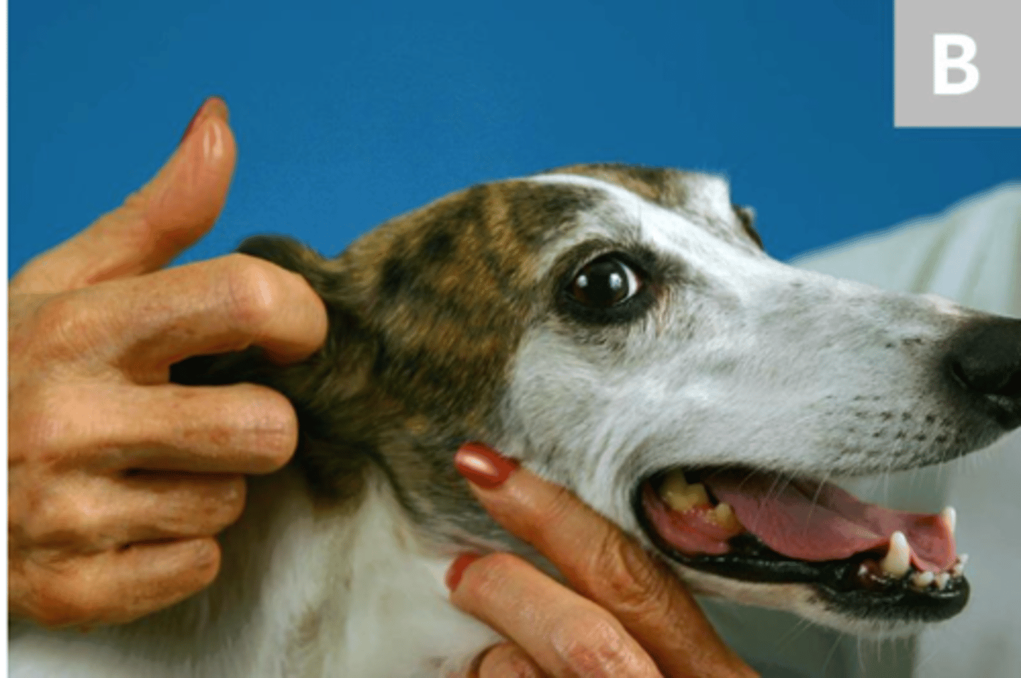 <p>what reflex/nerve are we testing here?</p>