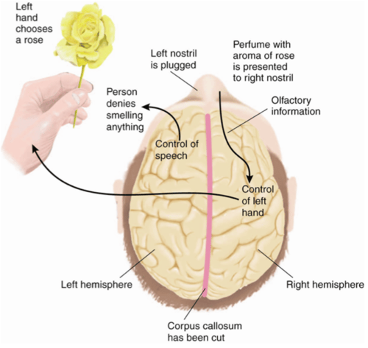 <p>- Ignoring objects on the side opposite to the damage</p><p>- EX. A man shaving will only shave left side if the right association cortex is damaged and he will believe he shaved his entire face</p>