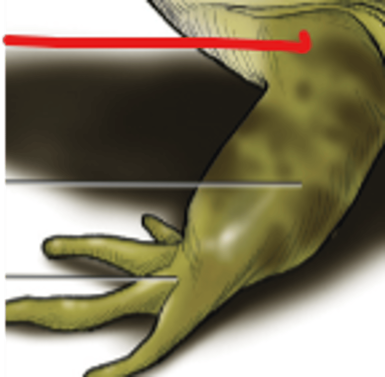 <p>Upper arm segment providing leverage for forelimb movement — Region between shoulder and elbow</p>