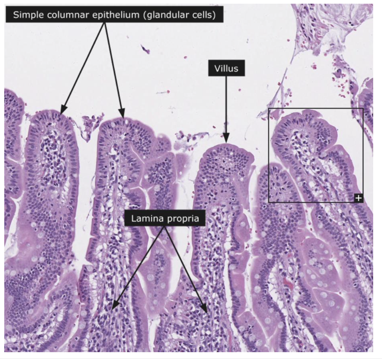 **Villi**