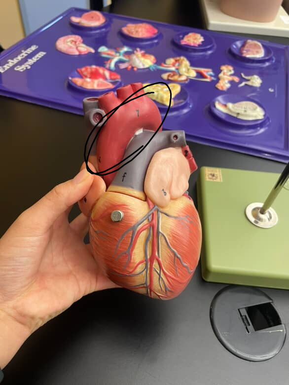 <p>the distinctive arch above the heart, with the descending aorta on the left side and ascending aorta on the right</p>
