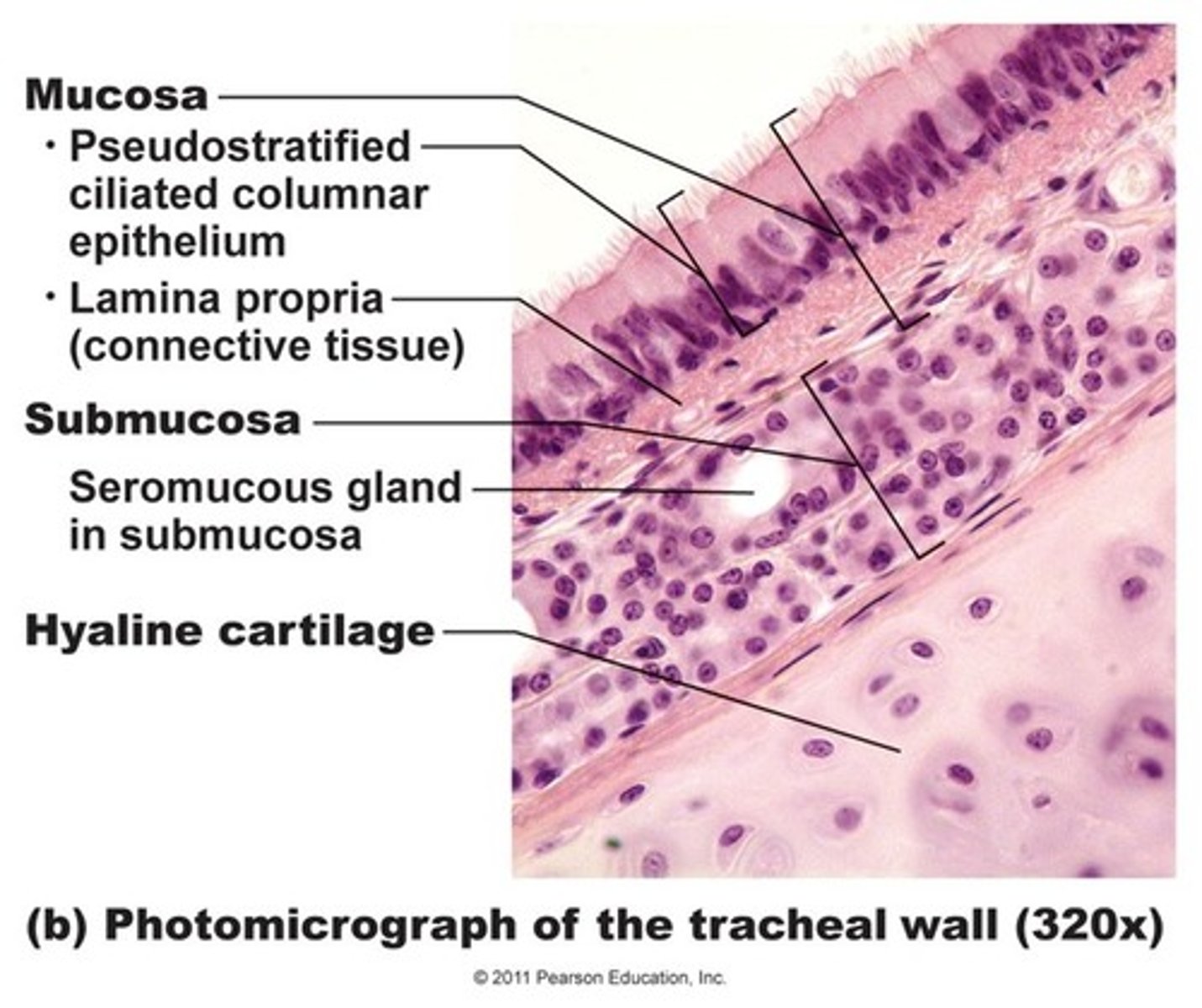 <p>Mucosa</p><p>Submucosa</p><p>Adventitia</p>