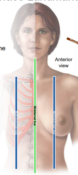 <p>A vertical surface landmark passing through the midpoint of the clavicle, parallel to midsternal line</p>