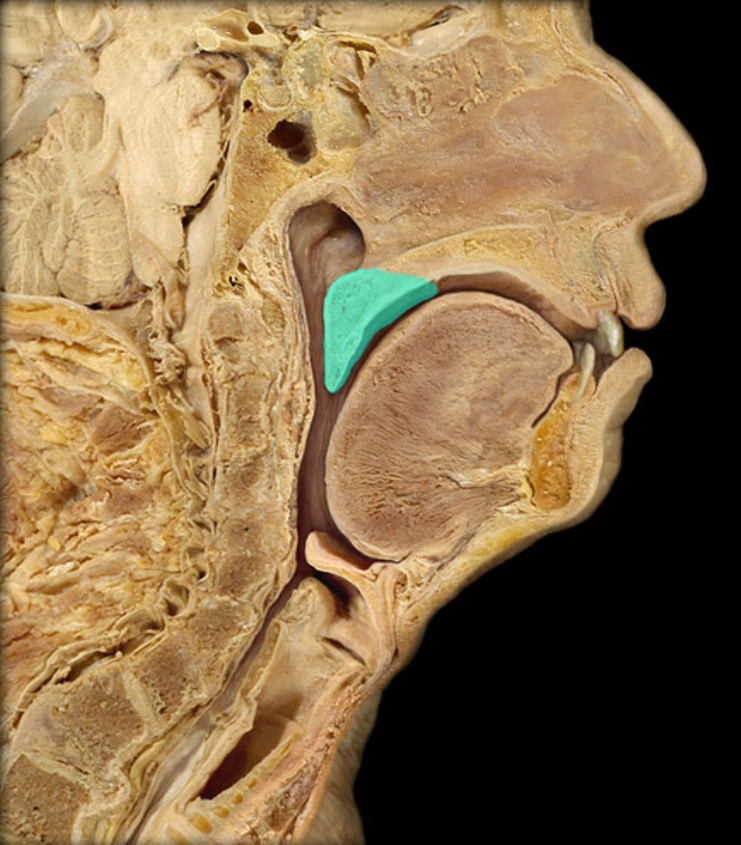 term image