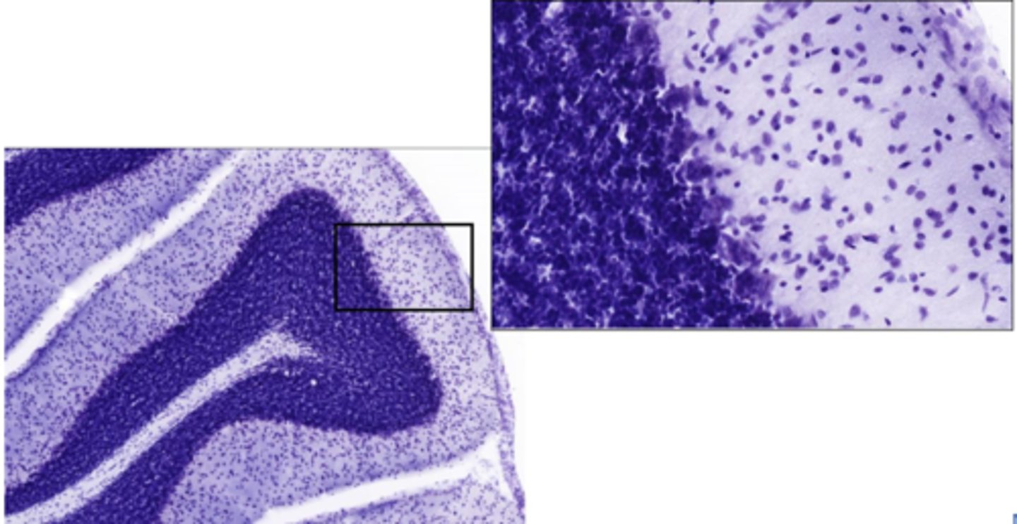 <p>Identify the portion of the CNS</p>