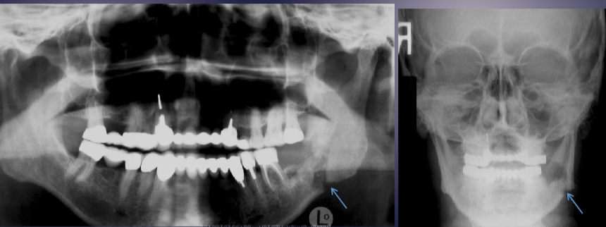 <p>what are the arrows pointing to&nbsp;</p>