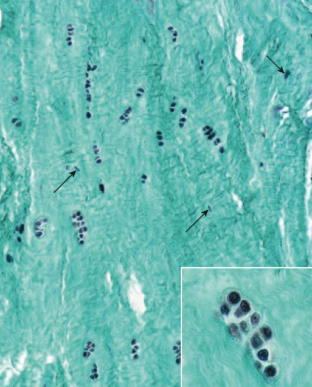 <p>what cartilage</p>