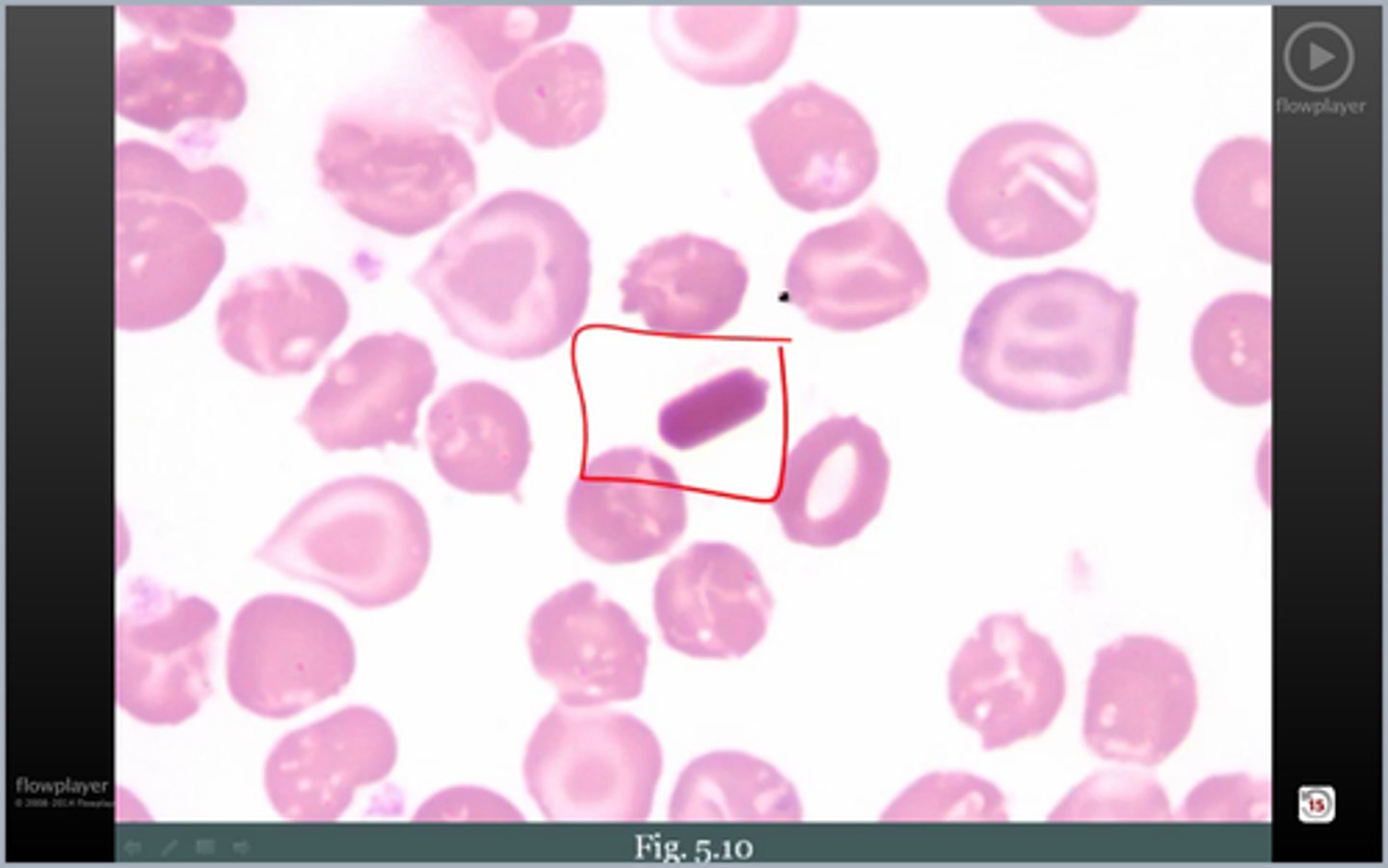 <p>wtf rbc3? cause?</p>