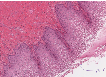 <p>What is stratified squamous ET, non-keratinized?</p>