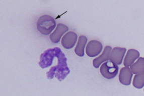 <p>What spreads&nbsp;Babesia spp.: B. canis, B. gibsoni, B. bovis </p>