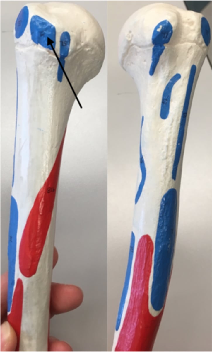 <p>74</p><p>O: Infraspinous fossa</p><p>I: Greater tubercle</p>