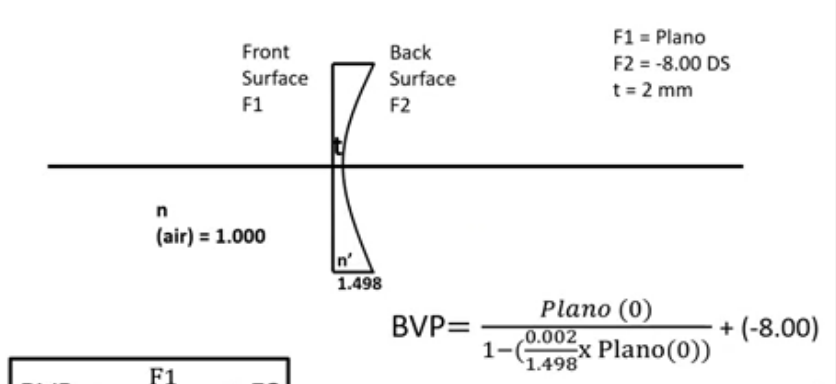 <p>F1= plano</p><p>F2= -8.00 </p><p>t= 2mm </p><p>bvp will be the rear surface power </p><p>bvp = F2= -8.00 DS</p>