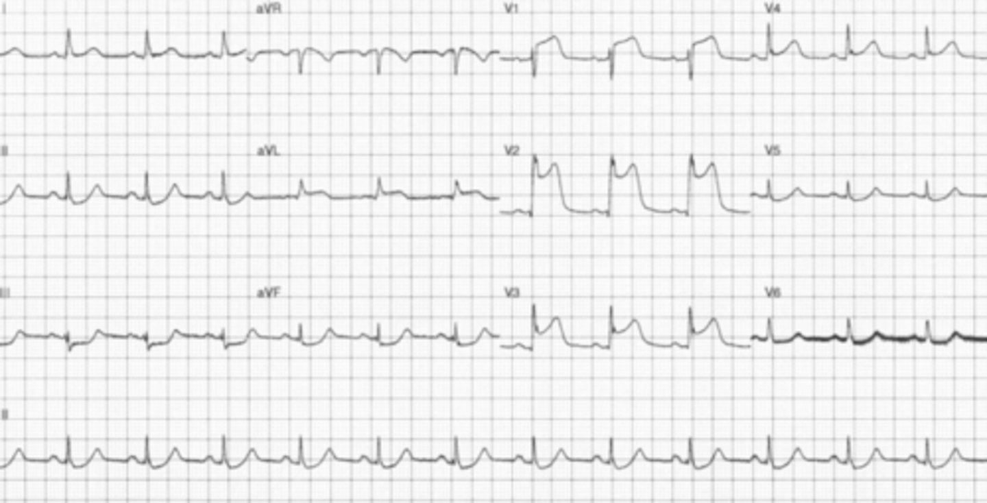 <p>What are the findings</p>