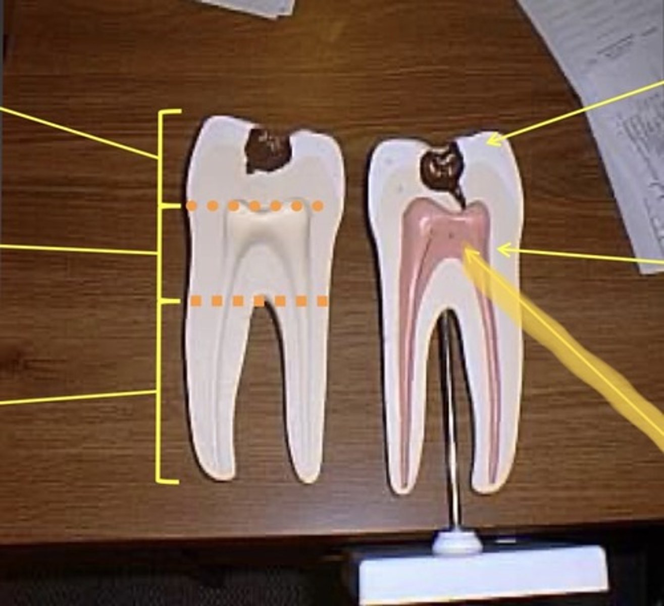 knowt flashcard image