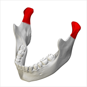 <p>What bone structure is the highlighted area?</p>