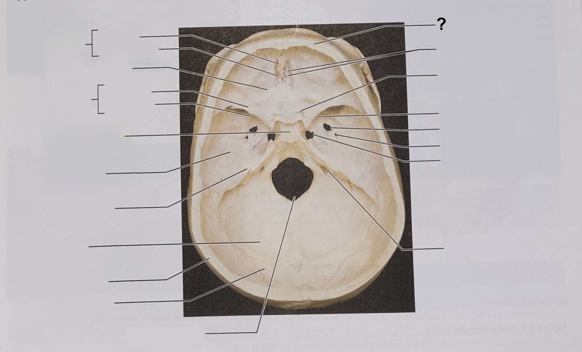 <p>Name the indicated structure</p>