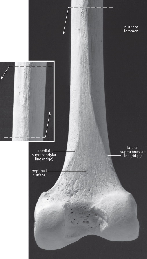 <p>fainter line on the posterior</p>
