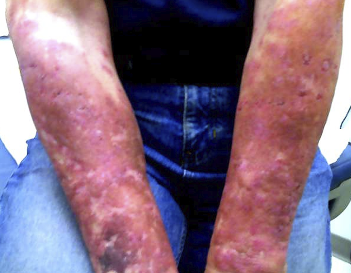 <p>What disease is this</p>