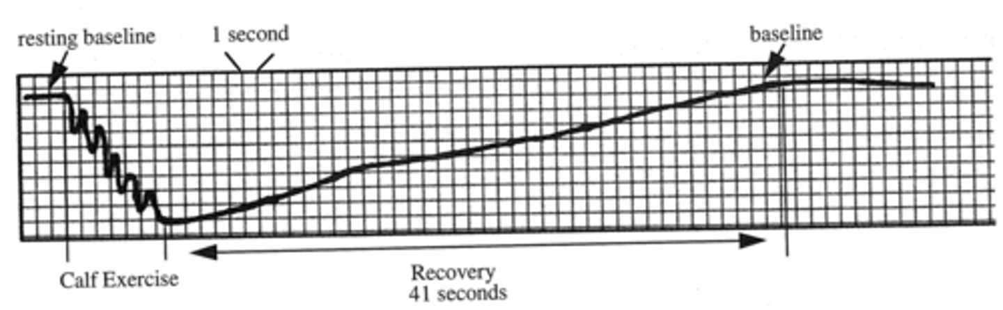 <p>Refill time/time to baseline > 20 seconds</p>