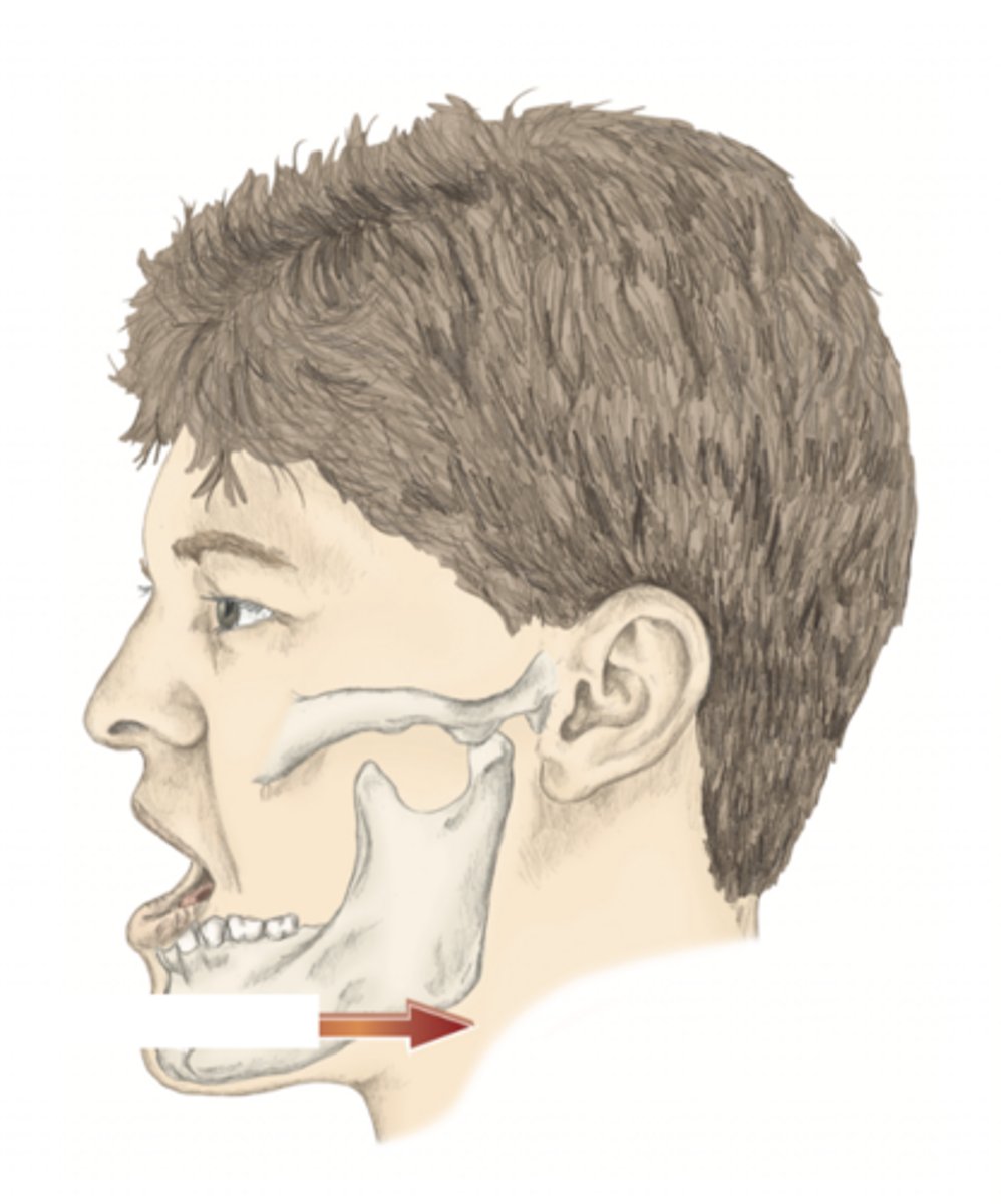 <p>please identify the movement and its location</p>