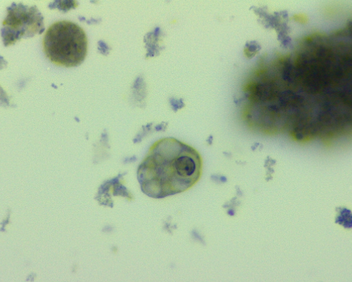 <p>Identify the organism and stage</p>