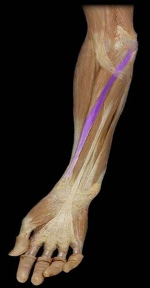 <p>What is the name of this muscle, highlighted in purple?</p>