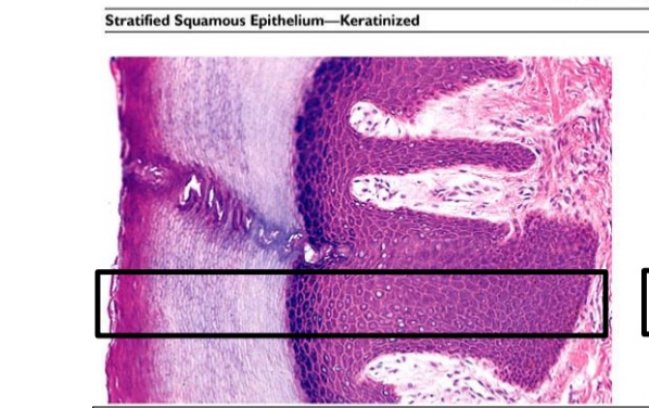 <ul><li><p>Thin layer of dead cells</p></li><li><p>Fluctuates throughout</p></li></ul><p></p>