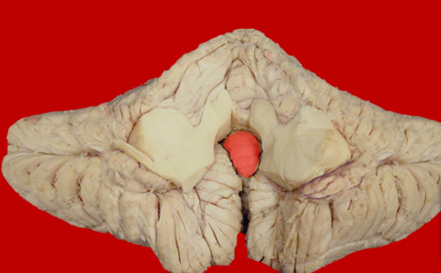 <p>Medial protrusion seen on the midsagittal view of the cerebellum; part of the vermis</p>