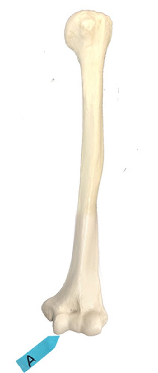 <p>Identify this bone marking.</p>