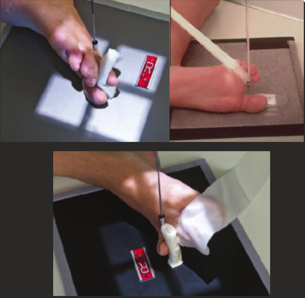 <ul><li><p>Rotate leg MEDIALLY for 1st-3rd toes and LATERALLY for 4th and 5th toes.</p></li><li><p>Long axis of foot parallel to IR, ensure toe of interest is true lateral position.</p></li><li><p>Use tape or radiolucent aids to separate toes (improvise).</p></li><li><p>CR perp. to IR.</p></li><li><p>Include MT base proximally.</p></li></ul><p></p>