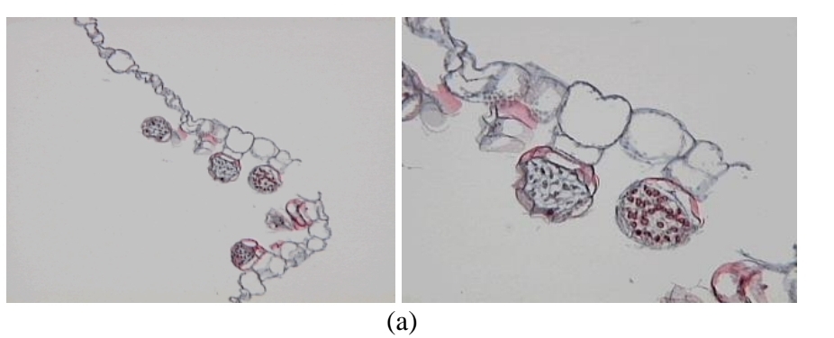 <p>Fern development - Male gametangia</p>