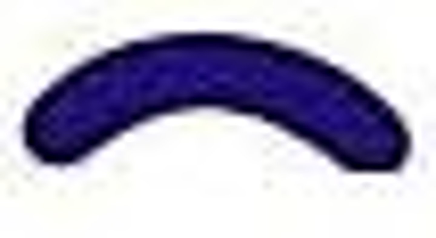 <p>comma shaped bacteria</p>