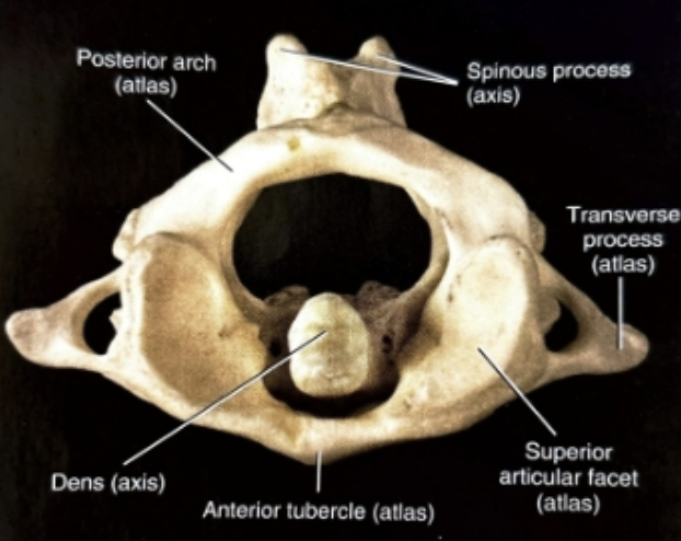 <p>Atlas- supports the weight of cranium, large transverese process</p>