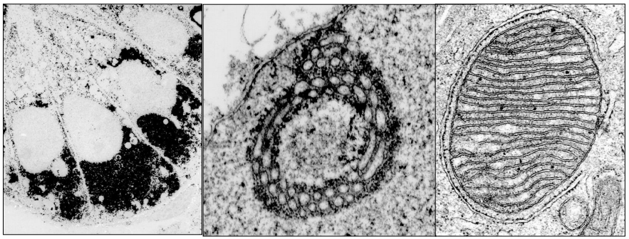 <p>Where is this epithelium</p>