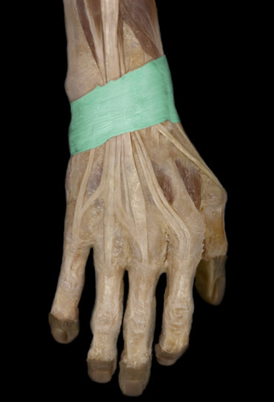 knowt flashcard image