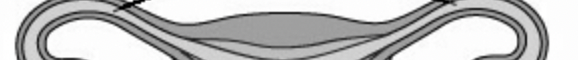 <p>Tubes to the uterus, extends near ovaries into uterus. Sweeps up egg from ovary using cilia lining and wafting fimbria at end of the fallopian tubes. Fertilization occurs in the upper part of this. </p>