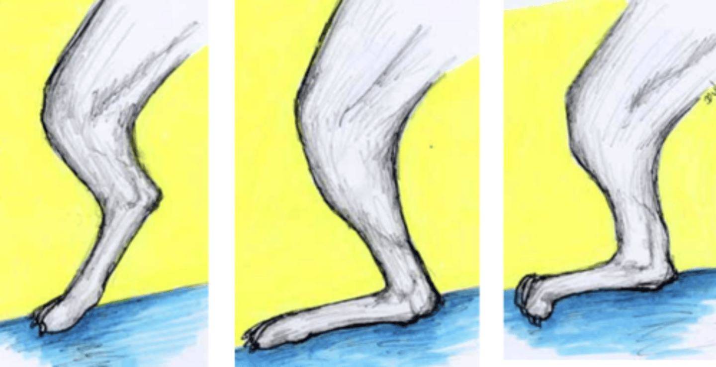 <p>Describe each stance and a common cause of each (if they are pathologic).</p>