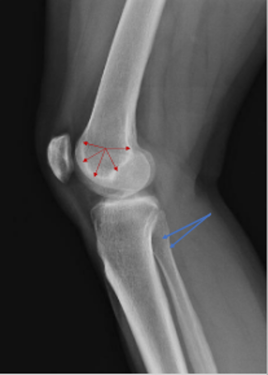 <p>What are the blue arrows pointing to?</p>