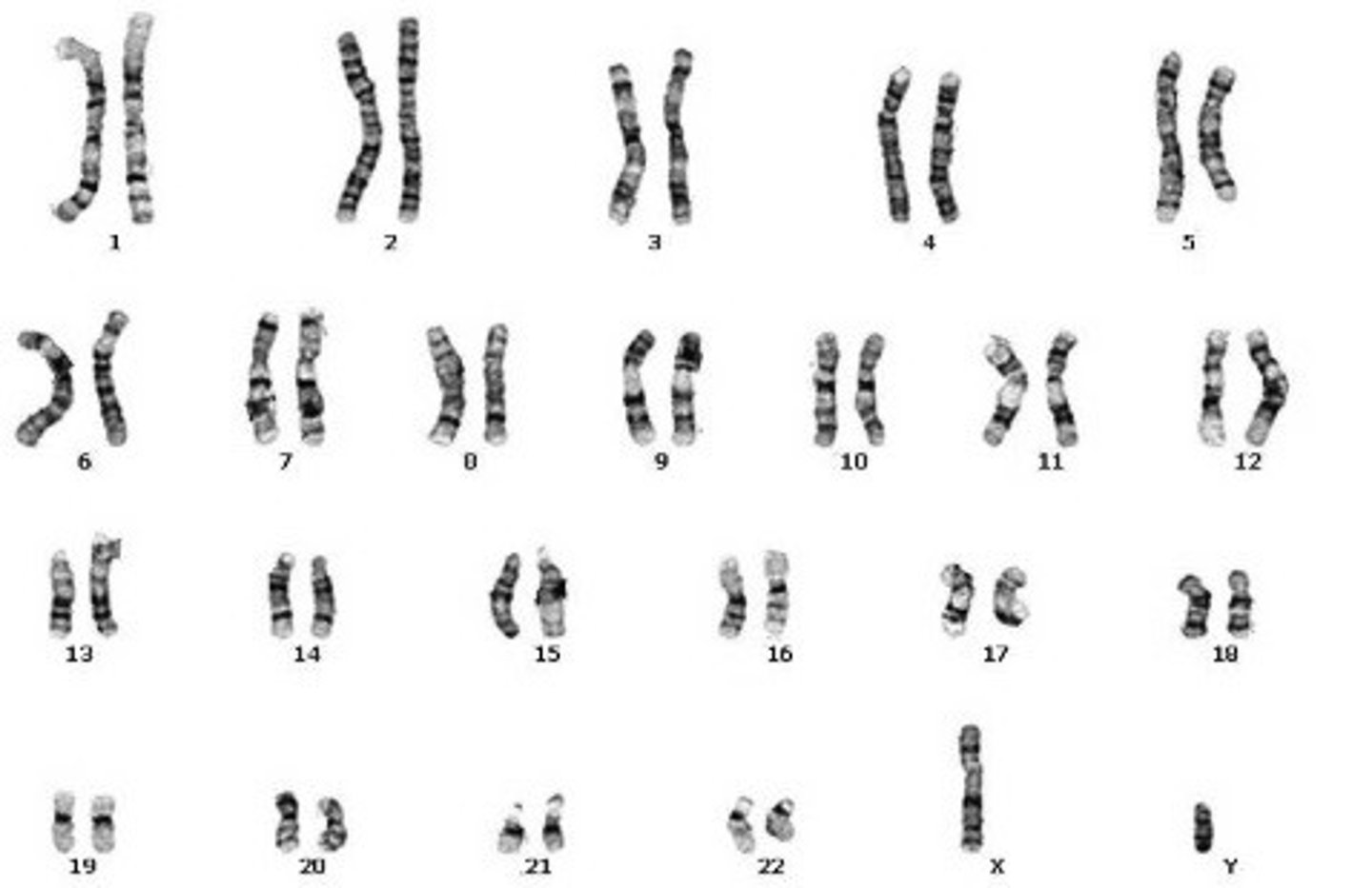 <p>XY - If the 23rd pair of chromosomes are the different sizes, XY, then the organism is a male.</p>