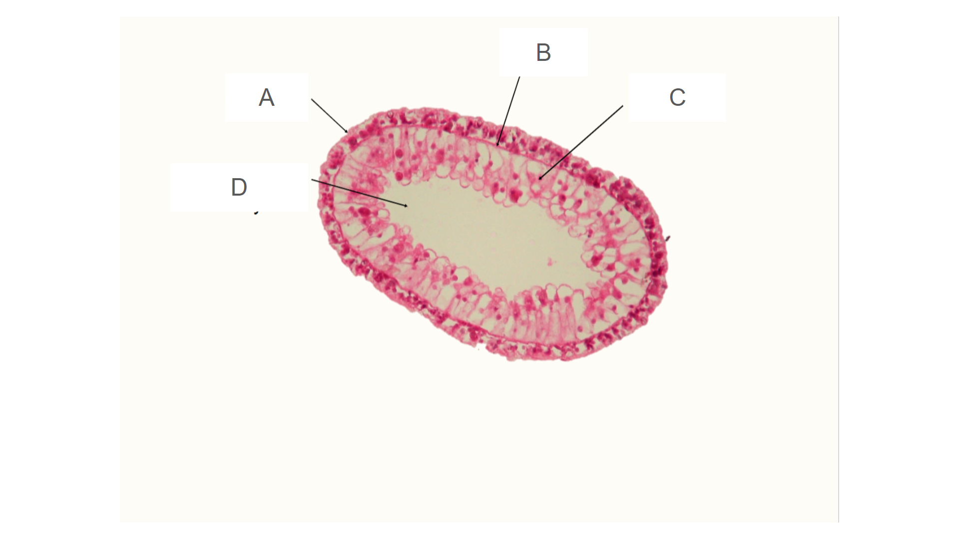 <p>What tissue layer is B?</p>