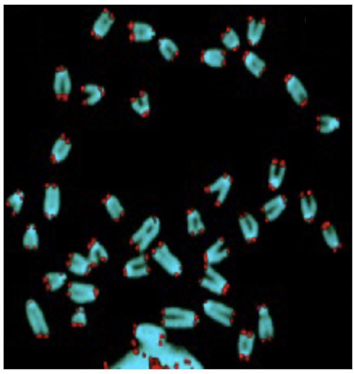 <p>FISH Flourecence In Situ Hybridization</p>